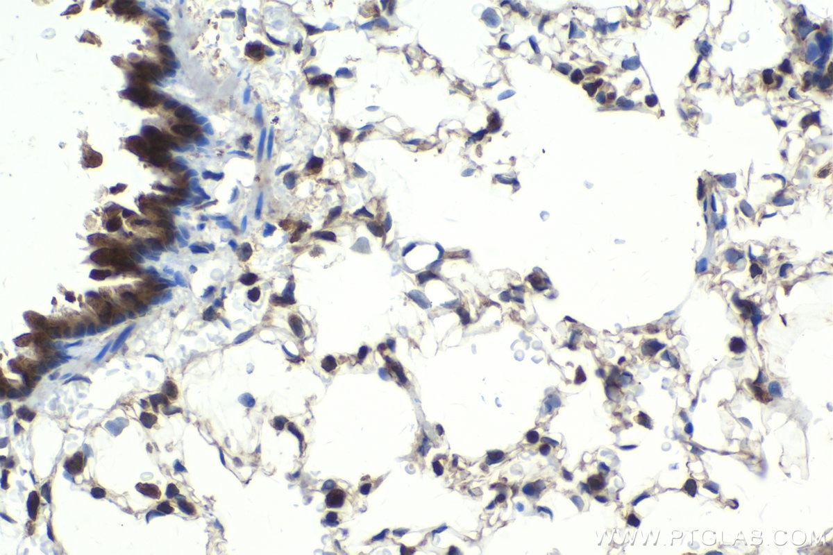 Immunohistochemistry (IHC) staining of rat lung tissue using IKBKG Polyclonal antibody (18474-1-AP)