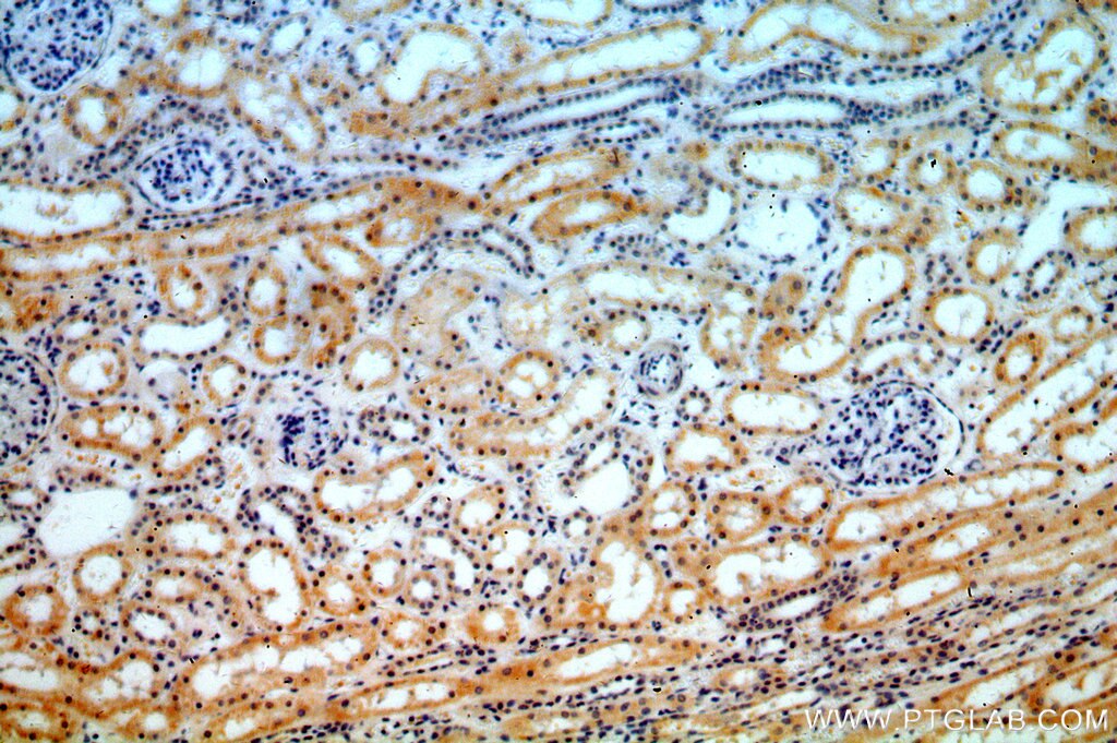 IHC staining of human kidney using 18474-1-AP