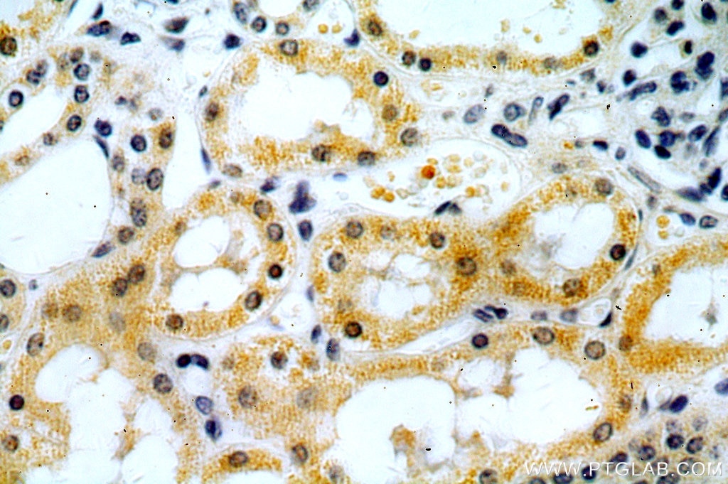 Immunohistochemistry (IHC) staining of human kidney tissue using IKBKG Polyclonal antibody (18474-1-AP)