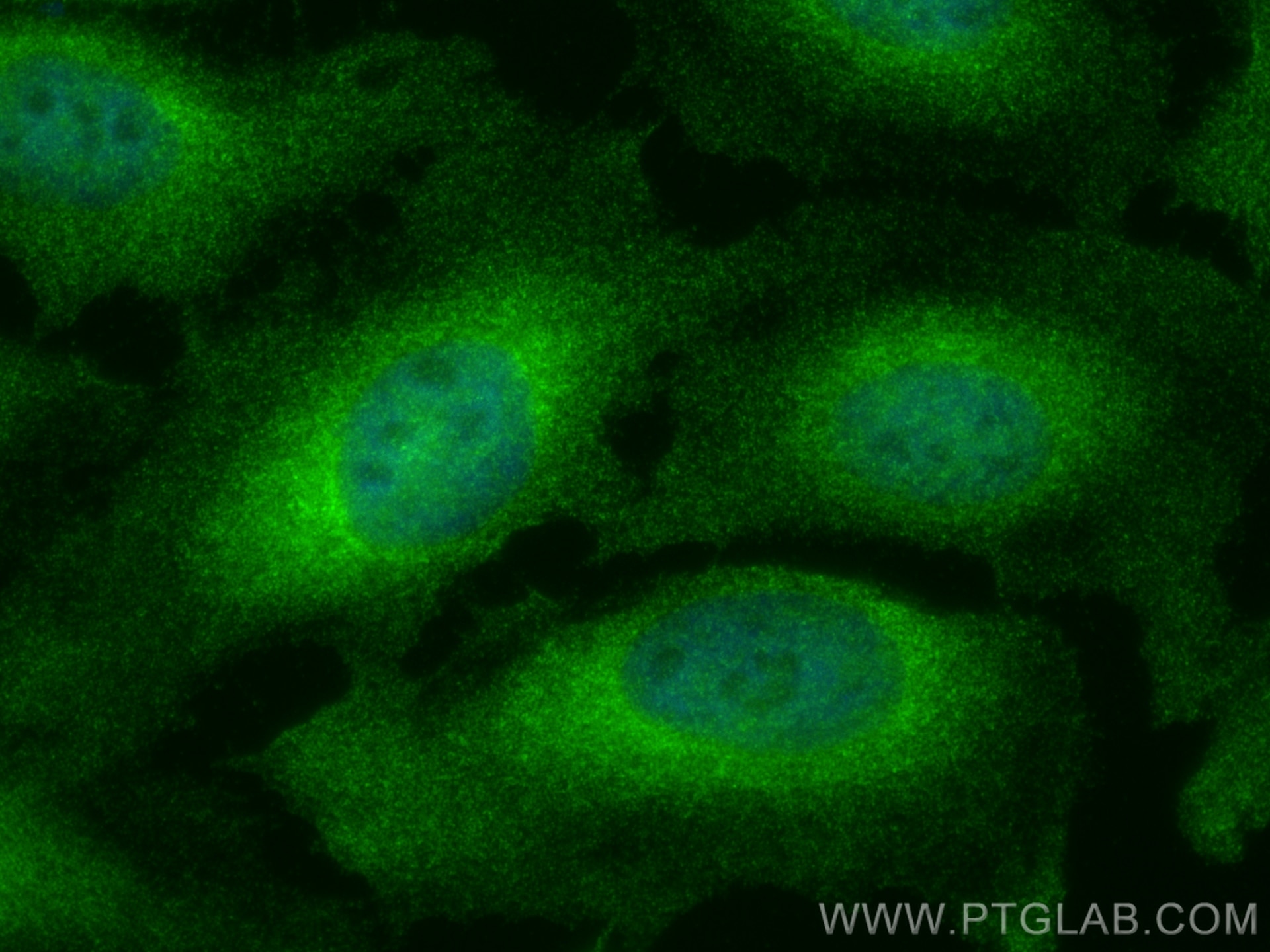 Immunofluorescence (IF) / fluorescent staining of HeLa cells using IKBKG Monoclonal antibody (66460-1-Ig)