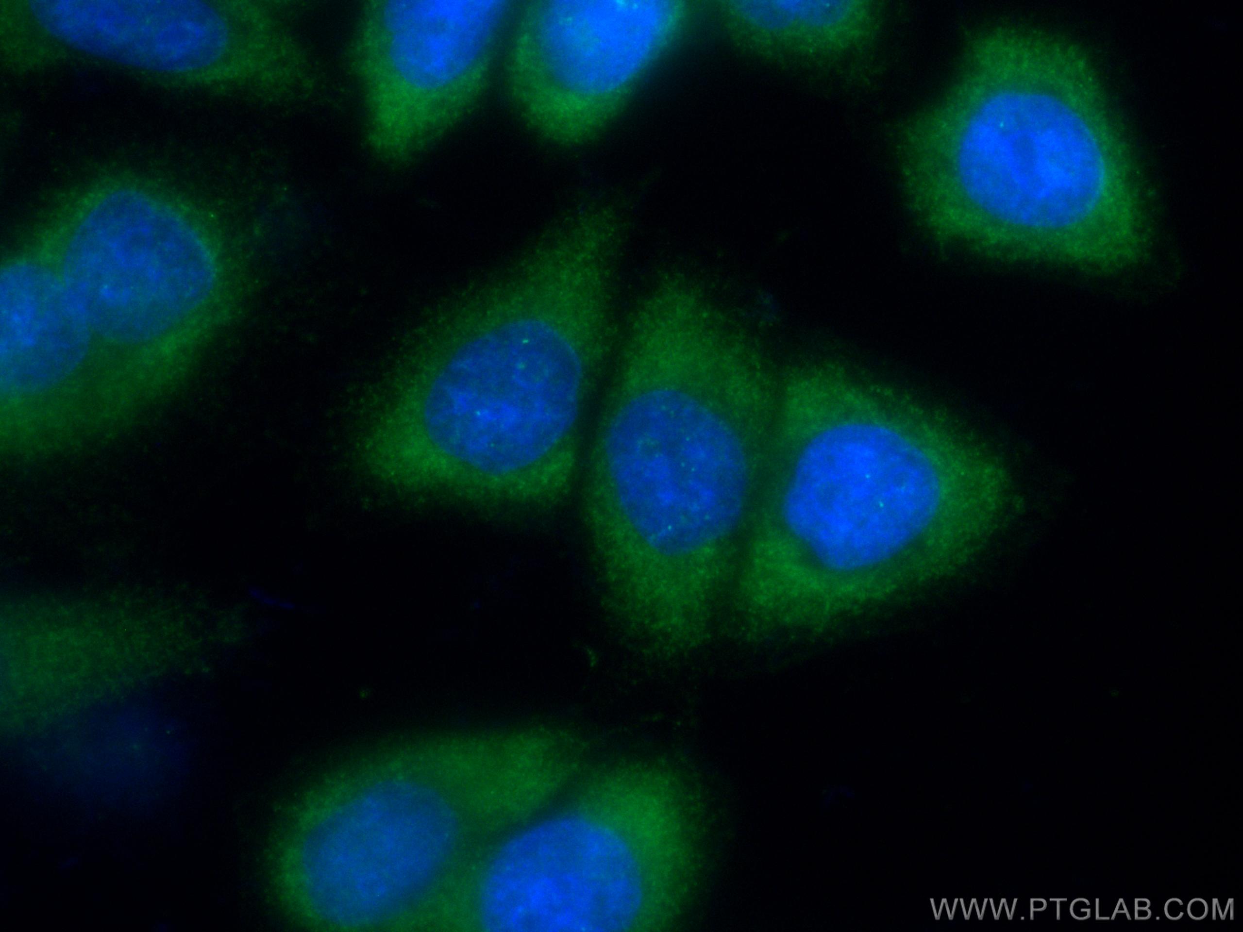 Immunofluorescence (IF) / fluorescent staining of HeLa cells using CoraLite® Plus 488-conjugated IKBKG Monoclonal ant (CL488-66460)