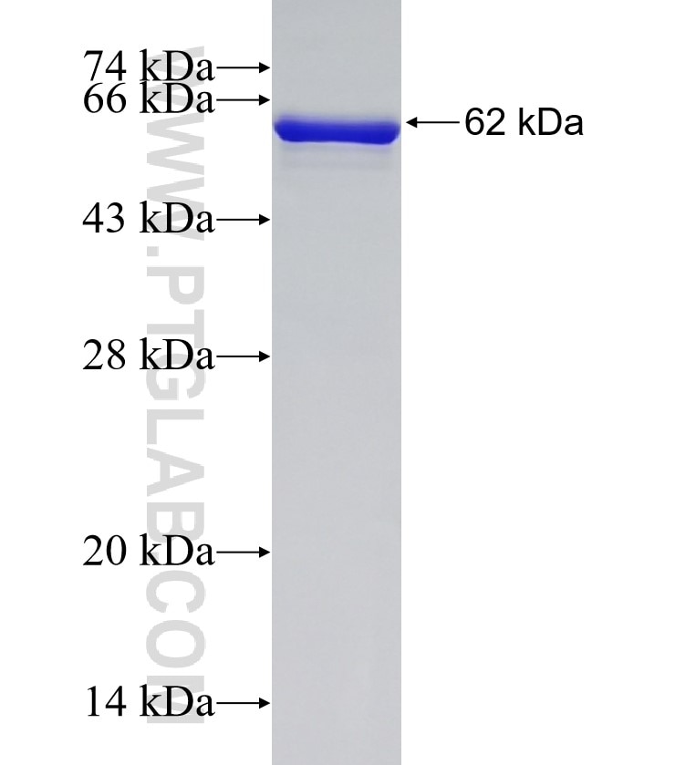 IKBKG fusion protein Ag13358 SDS-PAGE