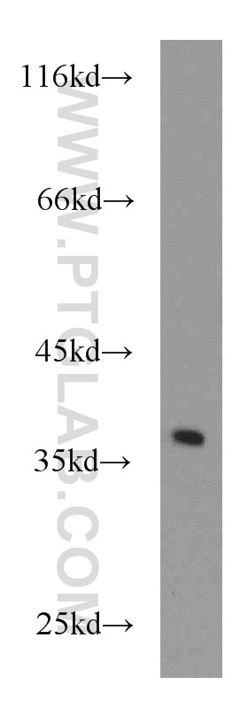 Western Blot (WB) analysis of mouse spleen tissue using IKIP Polyclonal antibody (14589-1-AP)