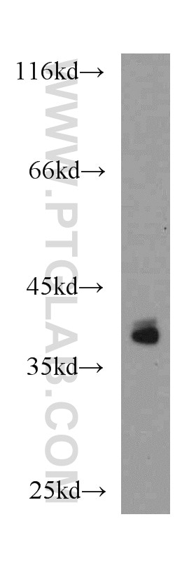 Western Blot (WB) analysis of mouse skeletal muscle tissue using IKIP Polyclonal antibody (14589-1-AP)
