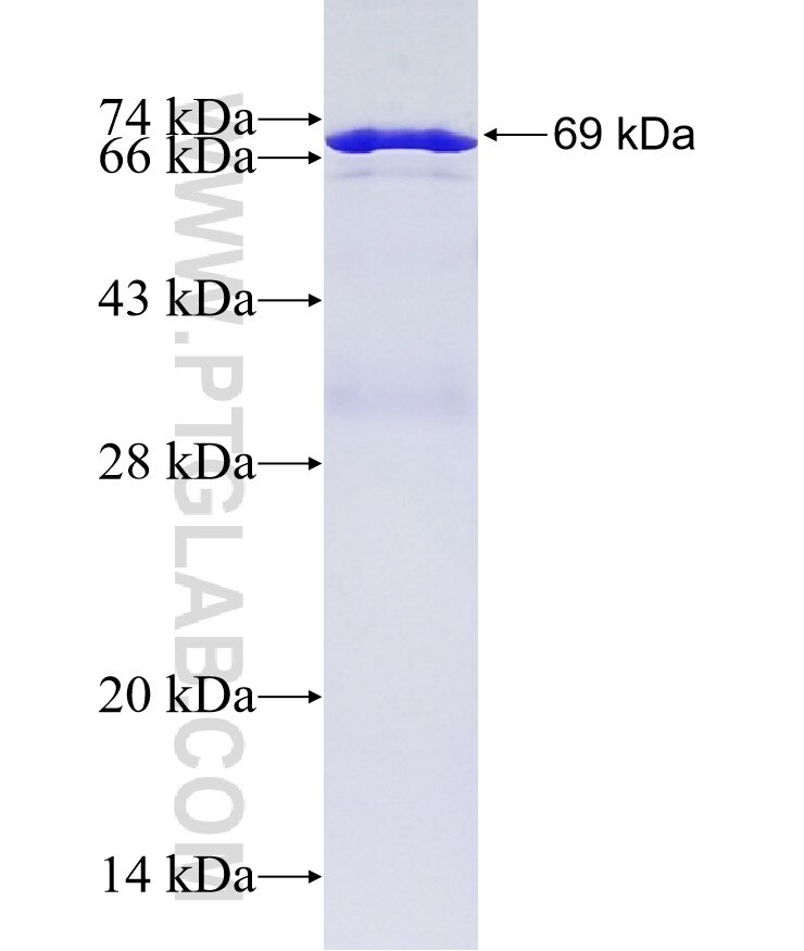 IKIP fusion protein Ag6119 SDS-PAGE