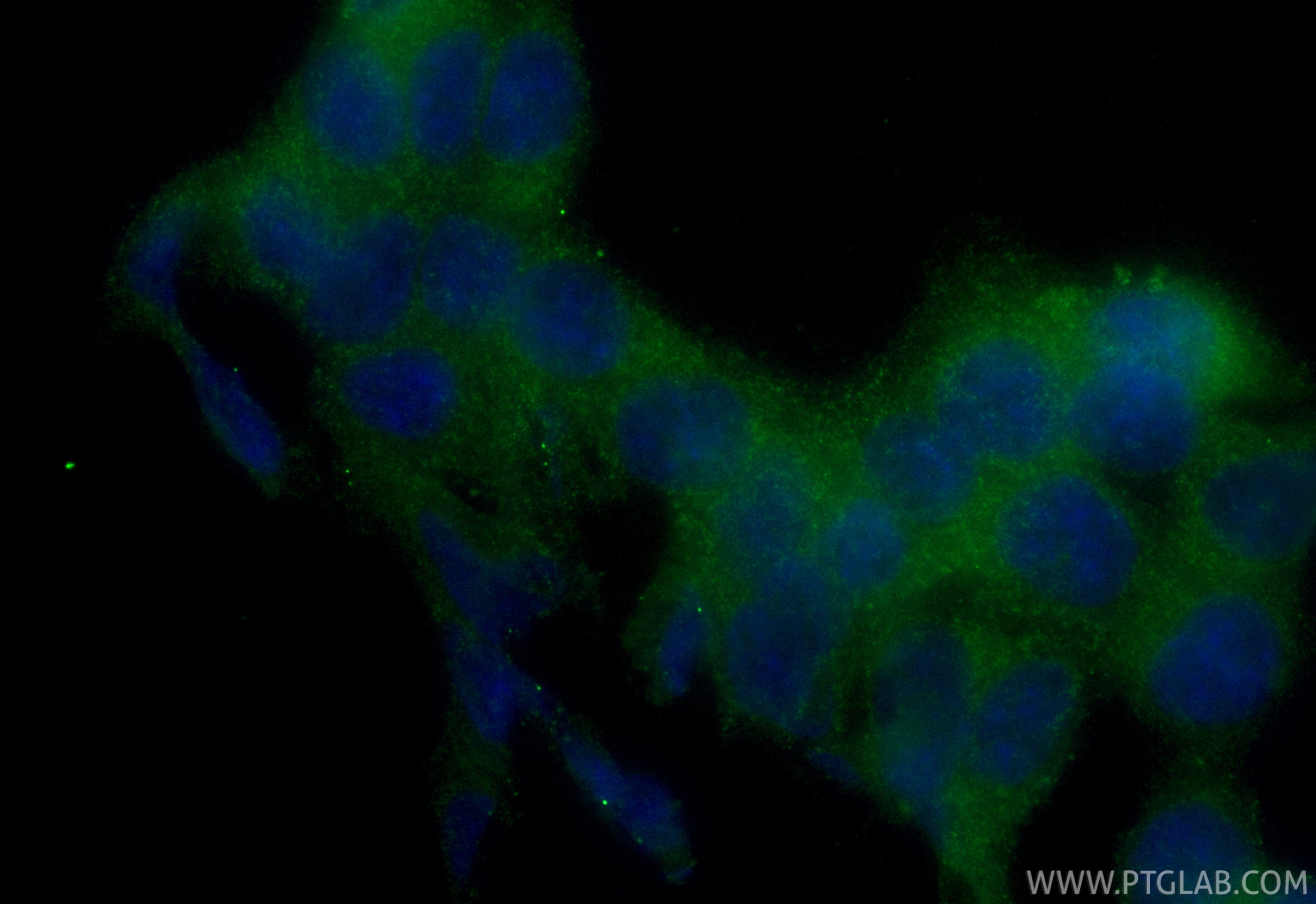 Immunofluorescent analysis of (4% PFA) fixed HCT 116 cells using CoraLite® Plus 488 IKKA antibody (CL488-84372-5, Clone: 241579D12 ) at dilution of 1:200. Immunofluorescence (IF) / fluorescent staining of HCT 116 cells using CoraLite® Plus 488-conjugated IKKA Recombinant mon (CL488-84372-5)