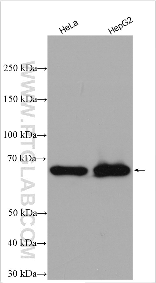 Western Blot (WB) analysis of HeLa cells using IKZF1 Polyclonal antibody (12016-1-AP)