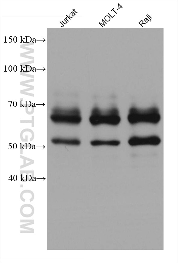 Western Blot (WB) analysis of various lysates using IKZF1 Monoclonal antibody (66966-1-Ig)