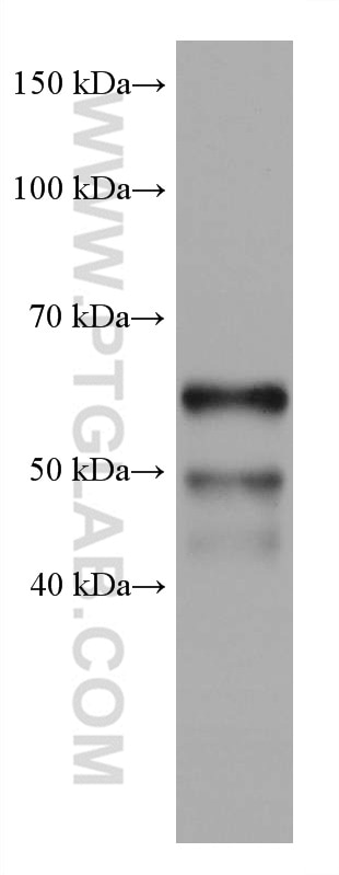 Western Blot (WB) analysis of pig thymus tissue using IKZF1 Monoclonal antibody (66966-1-Ig)