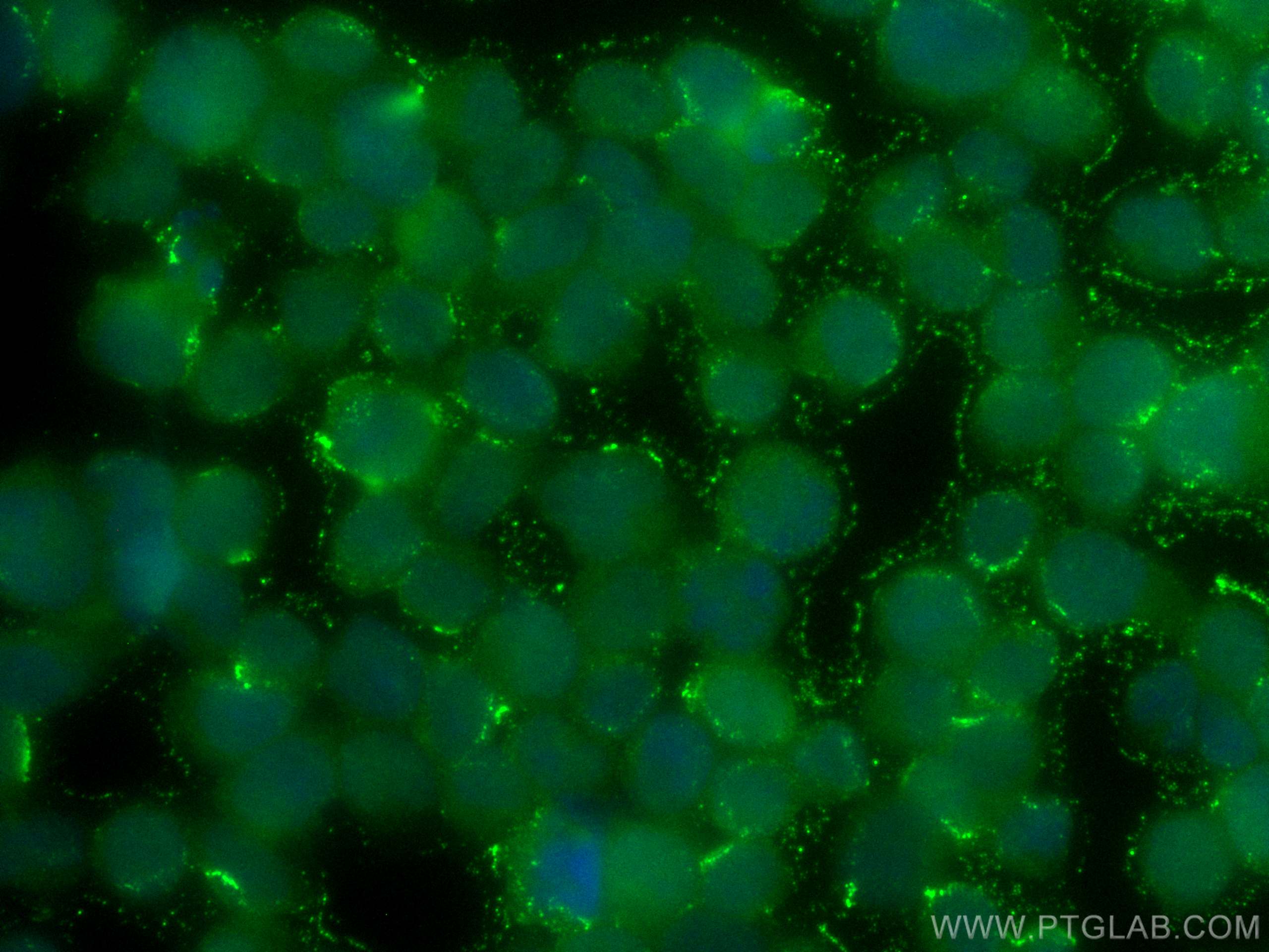 Immunofluorescence (IF) / fluorescent staining of Jurkat cells using CoraLite® Plus 488-conjugated IKZF1 Monoclonal ant (CL488-66966)