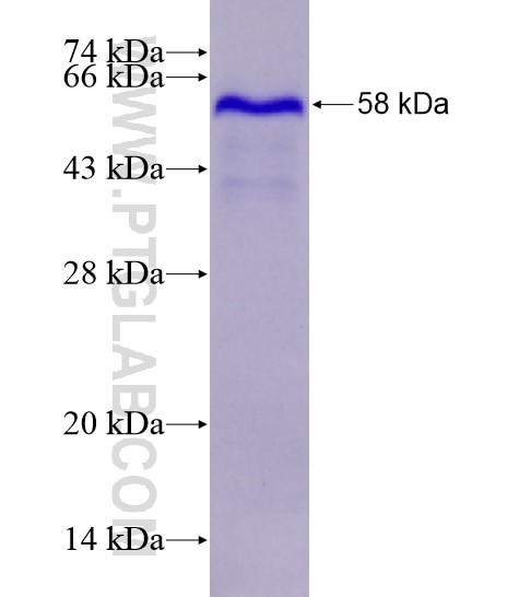 IKZF1 fusion protein Ag28637 SDS-PAGE
