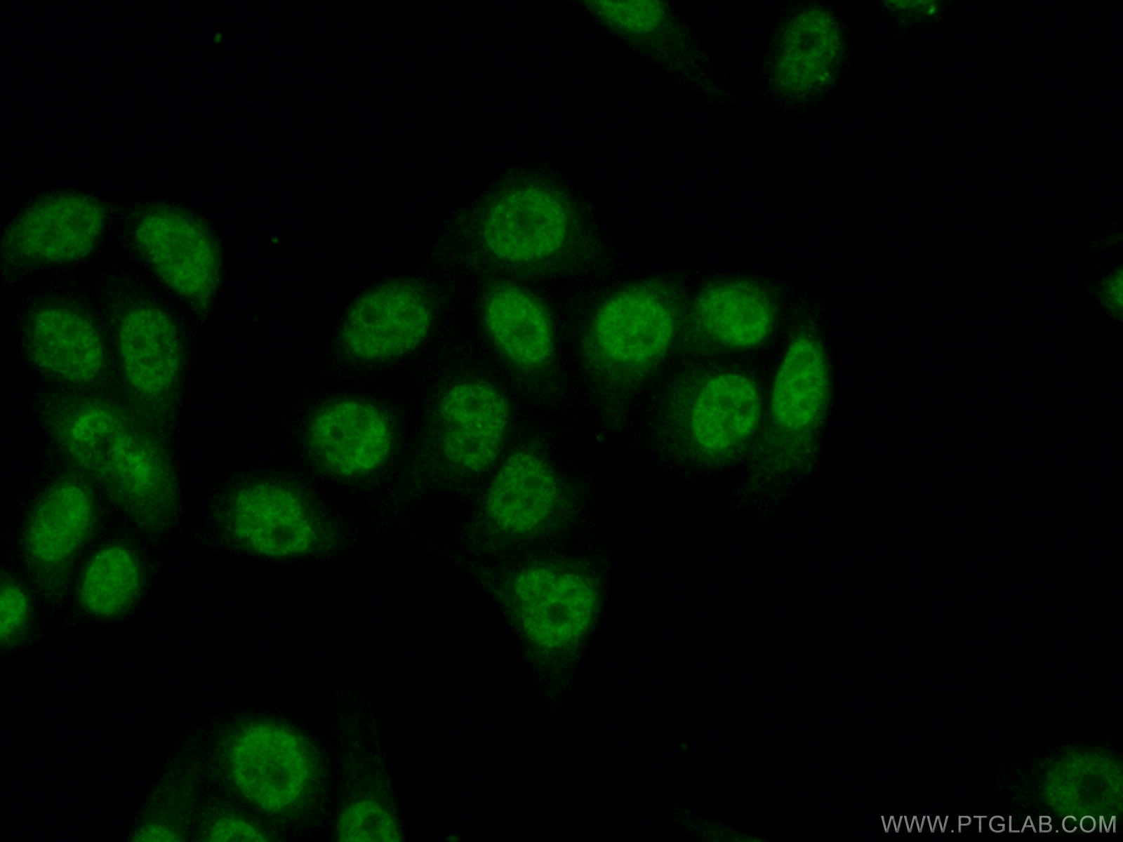 Immunofluorescence (IF) / fluorescent staining of HeLa cells using HELIOS Polyclonal antibody (13554-1-AP)