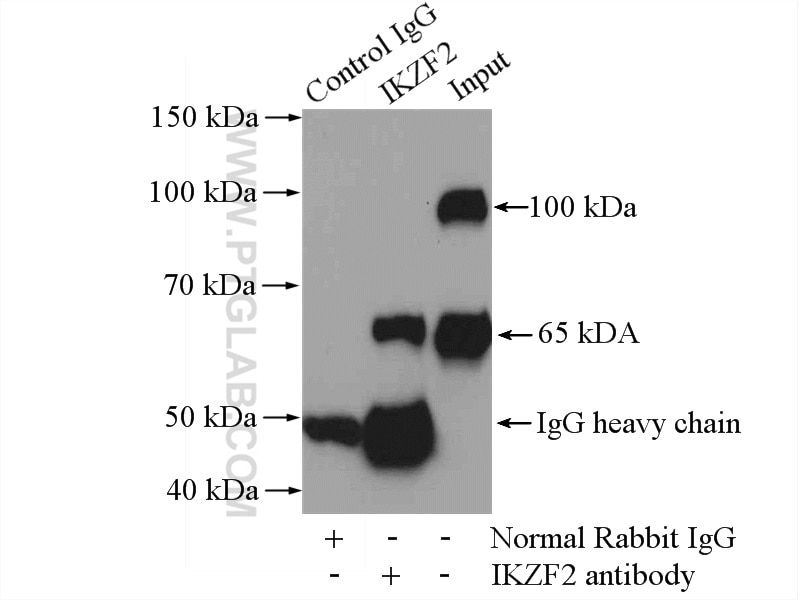 Immunoprecipitation (IP) experiment of Jurkat cells using HELIOS Polyclonal antibody (13554-1-AP)