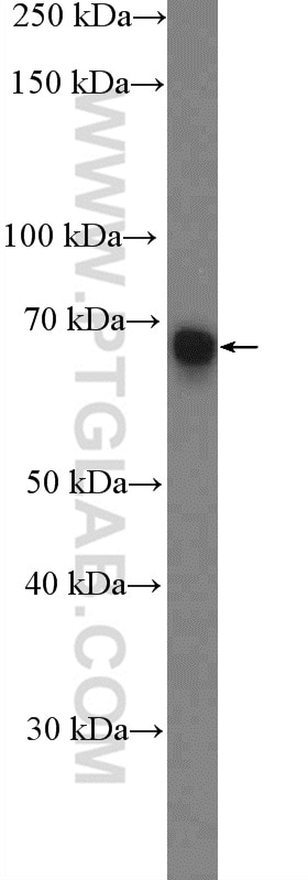Western Blot (WB) analysis of Jurkat cells using HELIOS Polyclonal antibody (13554-1-AP)