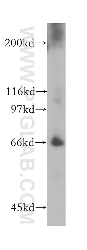Western Blot (WB) analysis of human placenta tissue using HELIOS Polyclonal antibody (13554-1-AP)