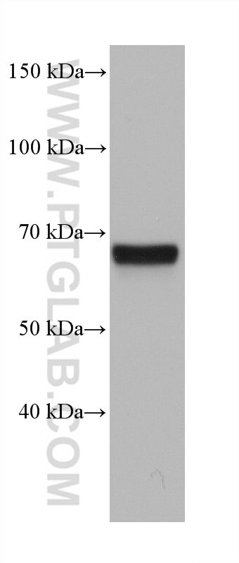 Western Blot (WB) analysis of Jurkat cells using HELIOS Monoclonal antibody (68558-1-Ig)