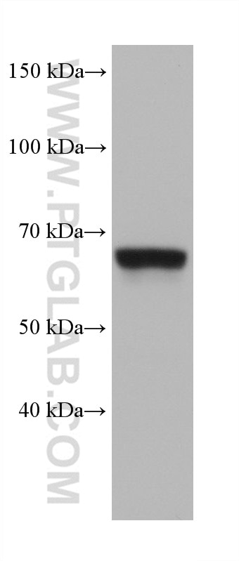 Western Blot (WB) analysis of MOLT-4 cells using HELIOS Monoclonal antibody (68558-1-Ig)