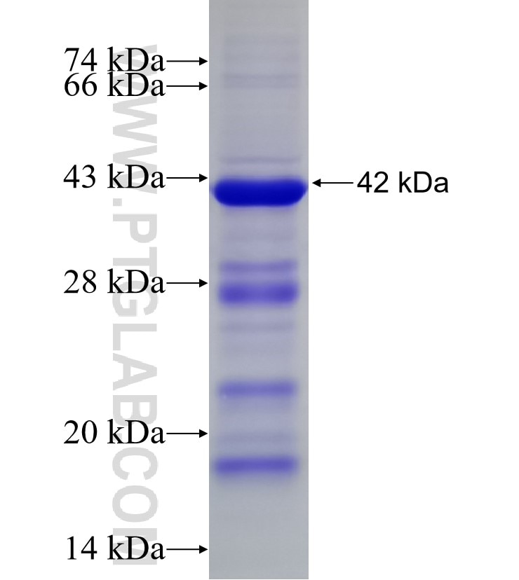 IKZF2 fusion protein Ag4357 SDS-PAGE