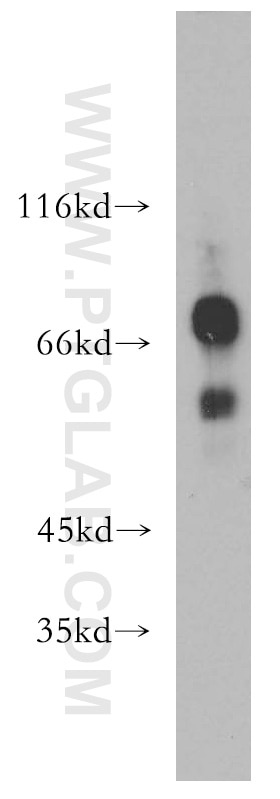 Western Blot (WB) analysis of Jurkat cells using IKZF3 Polyclonal antibody (13561-1-AP)