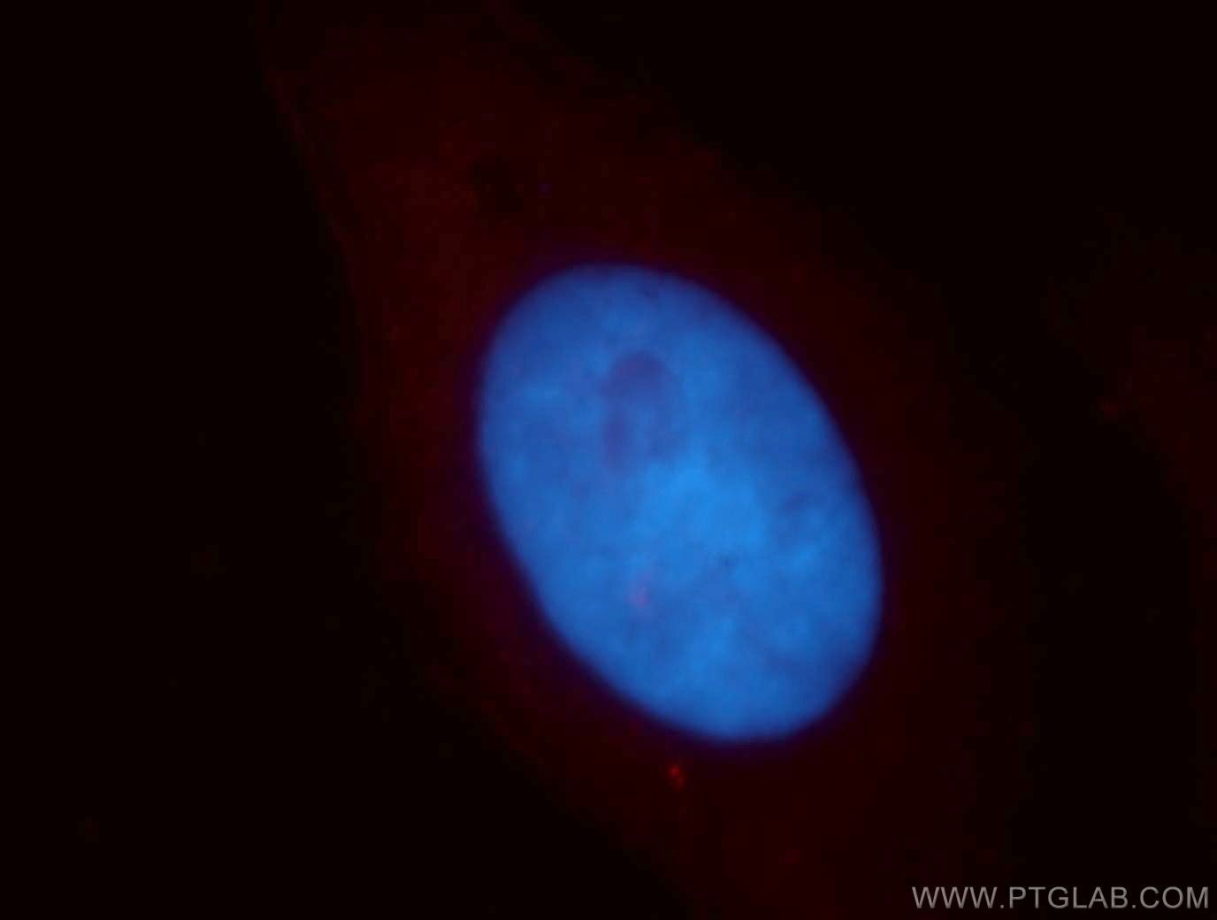Immunofluorescence (IF) / fluorescent staining of HepG2 cells using IKZF3 Polyclonal antibody (19055-1-AP)