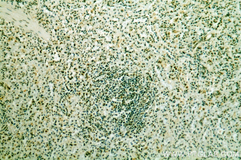 Immunohistochemistry (IHC) staining of human spleen tissue using IKZF3 Polyclonal antibody (19055-1-AP)