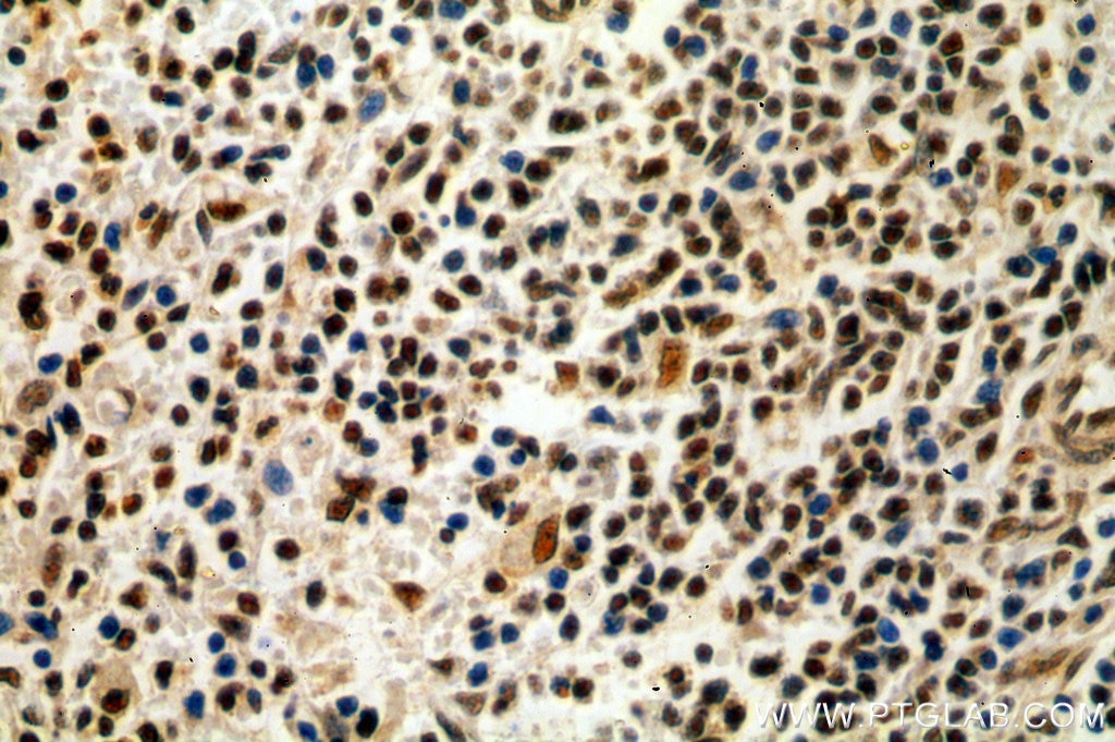 Immunohistochemistry (IHC) staining of human spleen tissue using IKZF3 Polyclonal antibody (19055-1-AP)