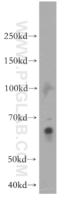 Western Blot (WB) analysis of Jurkat cells using IKZF3 Polyclonal antibody (19055-1-AP)