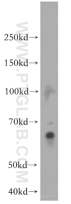 WB analysis of Jurkat using 19055-1-AP