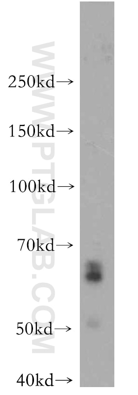 Western Blot (WB) analysis of Jurkat cells using IKZF3 Polyclonal antibody (19055-1-AP)