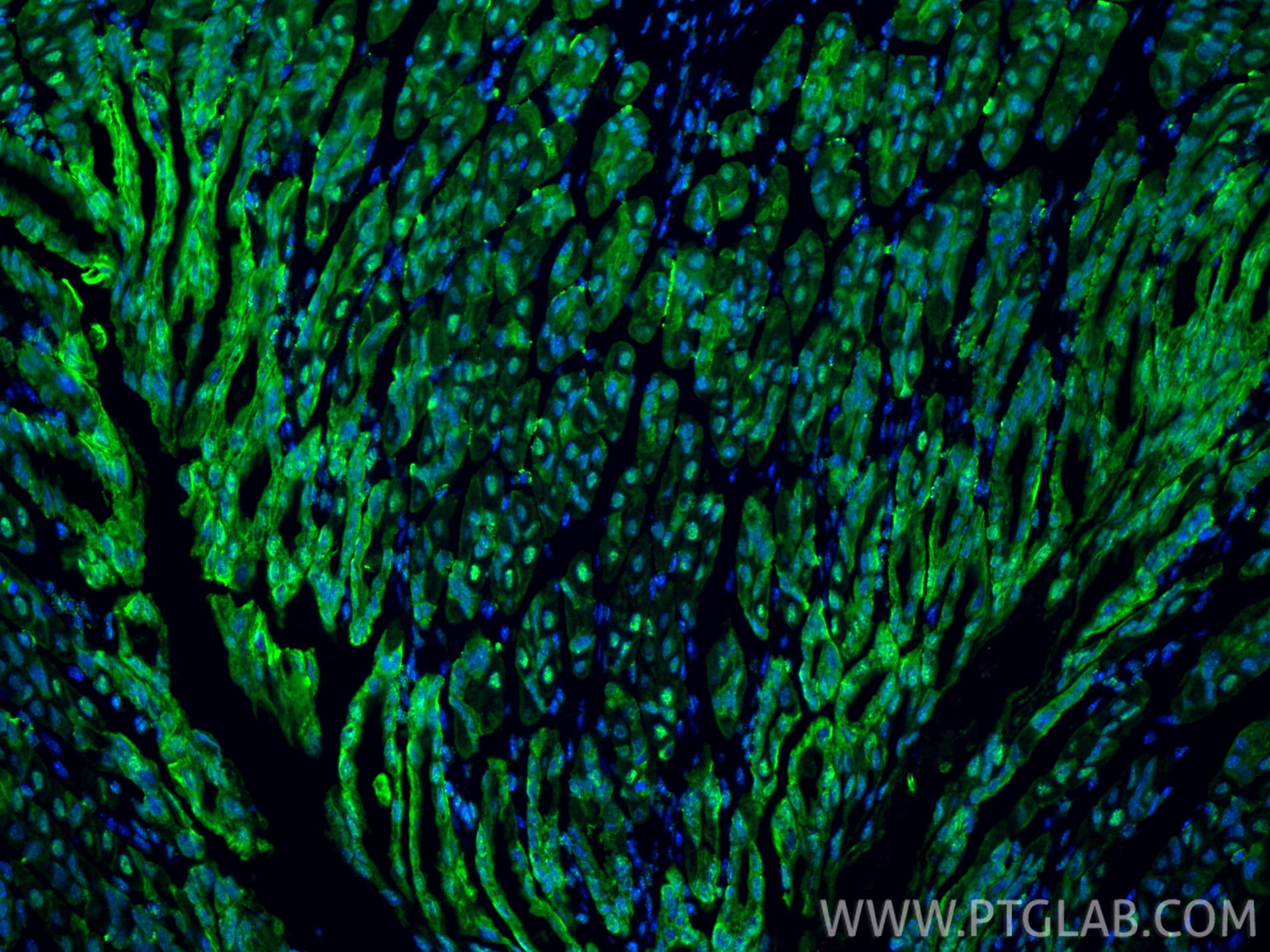 Immunofluorescence (IF) / fluorescent staining of mouse stomach tissue using IKZF4 Recombinant monoclonal antibody (83471-5-RR)