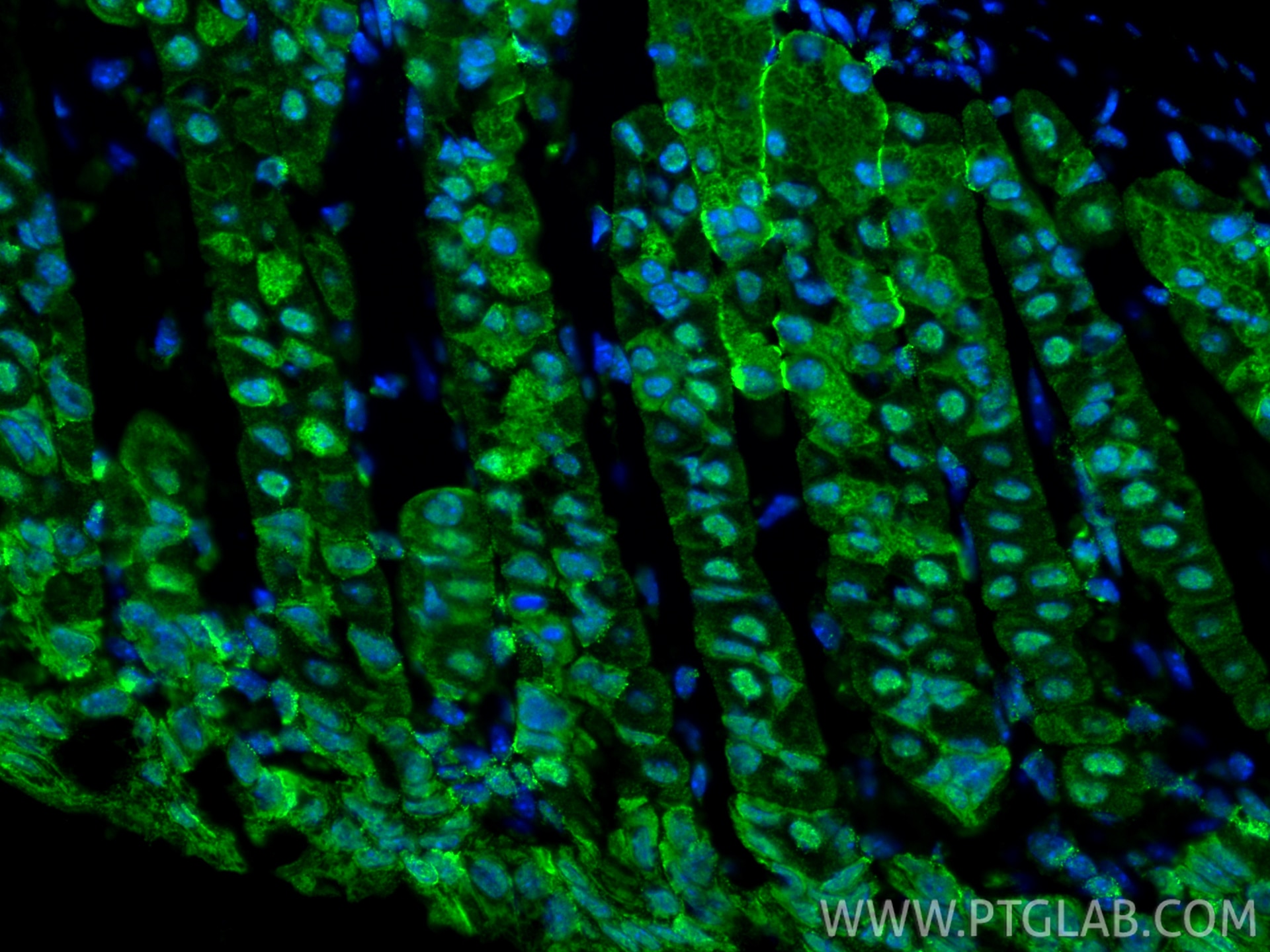 Immunofluorescence (IF) / fluorescent staining of mouse stomach tissue using IKZF4 Recombinant monoclonal antibody (83471-5-RR)