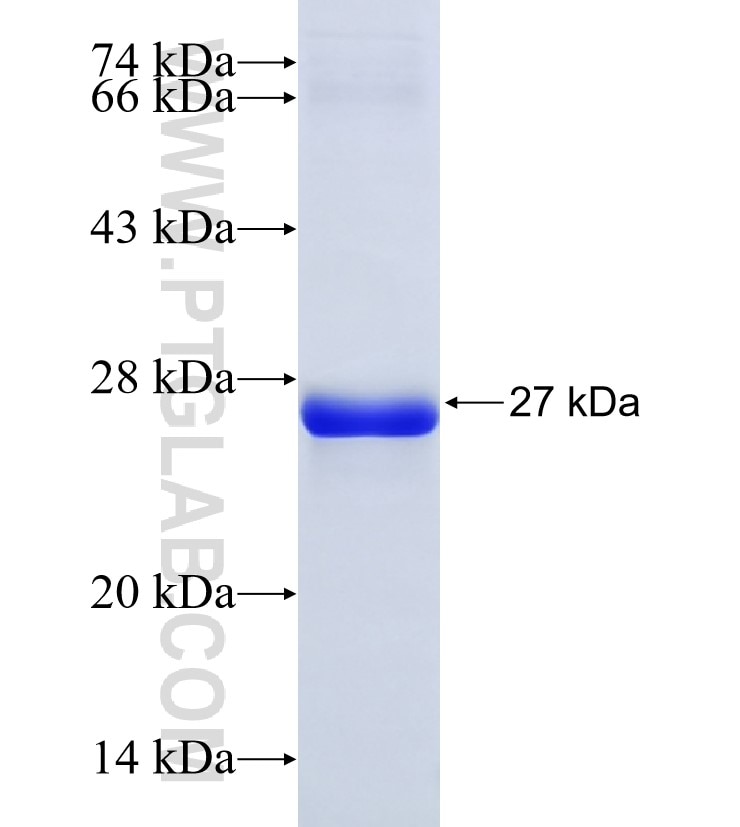 IKZF4 fusion protein Ag34792 SDS-PAGE IKZF4 fusion protein Ag34792 SDS-PAGE