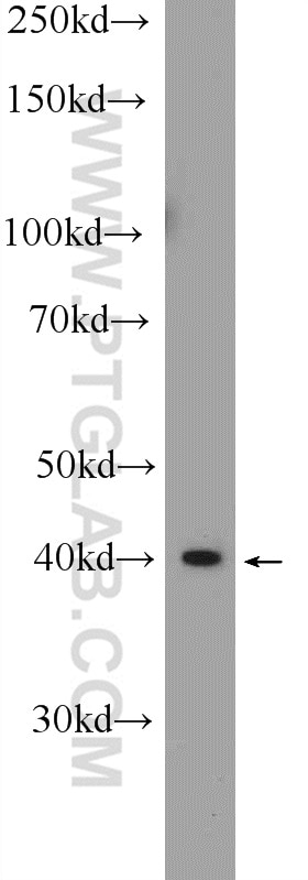 Western Blot (WB) analysis of HeLa cells using IKZF5 Polyclonal antibody (24780-1-AP)
