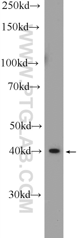 WB analysis of HeLa using 24780-1-AP