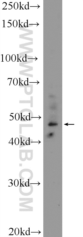 Western Blot (WB) analysis of HL-60 cells using IKZF5 Polyclonal antibody (24780-1-AP)