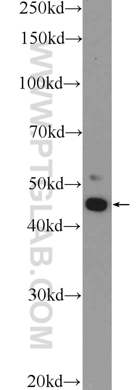 Western Blot (WB) analysis of Jurkat cells using IKZF5 Polyclonal antibody (24780-1-AP)