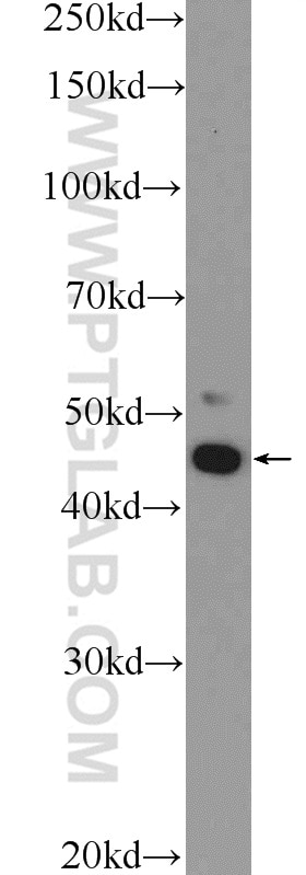 Western Blot (WB) analysis of Jurkat cells using IKZF5 Polyclonal antibody (24780-1-AP)