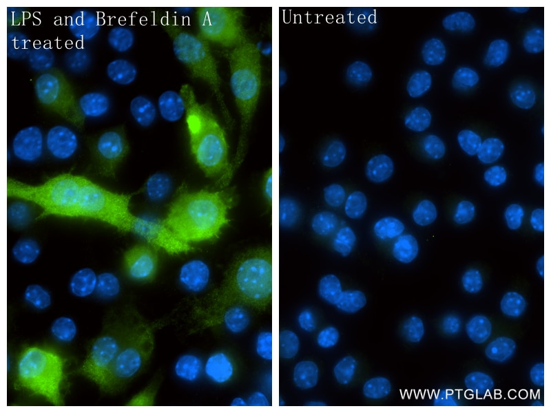 Immunofluorescent analysis of (4% PFA) fixed LPS and Brefeldin A treated RAW 264.7 cells using IL-1 beta antibody (84136-5-RR, Clone: 241364D5 ) at dilution of 1:1000 and CoraLite®488-Conjugated Goat Anti-Rabbit IgG(H+L) (SA00013-2). Immunofluorescence (IF) / fluorescent staining of RAW 264.7 cells using IL-1 beta Recombinant monoclonal antibody (84136-5-RR)