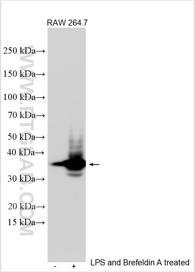 Western Blot (WB) analysis of various lysates using IL-1 beta Recombinant antibody (84136-5-RR)