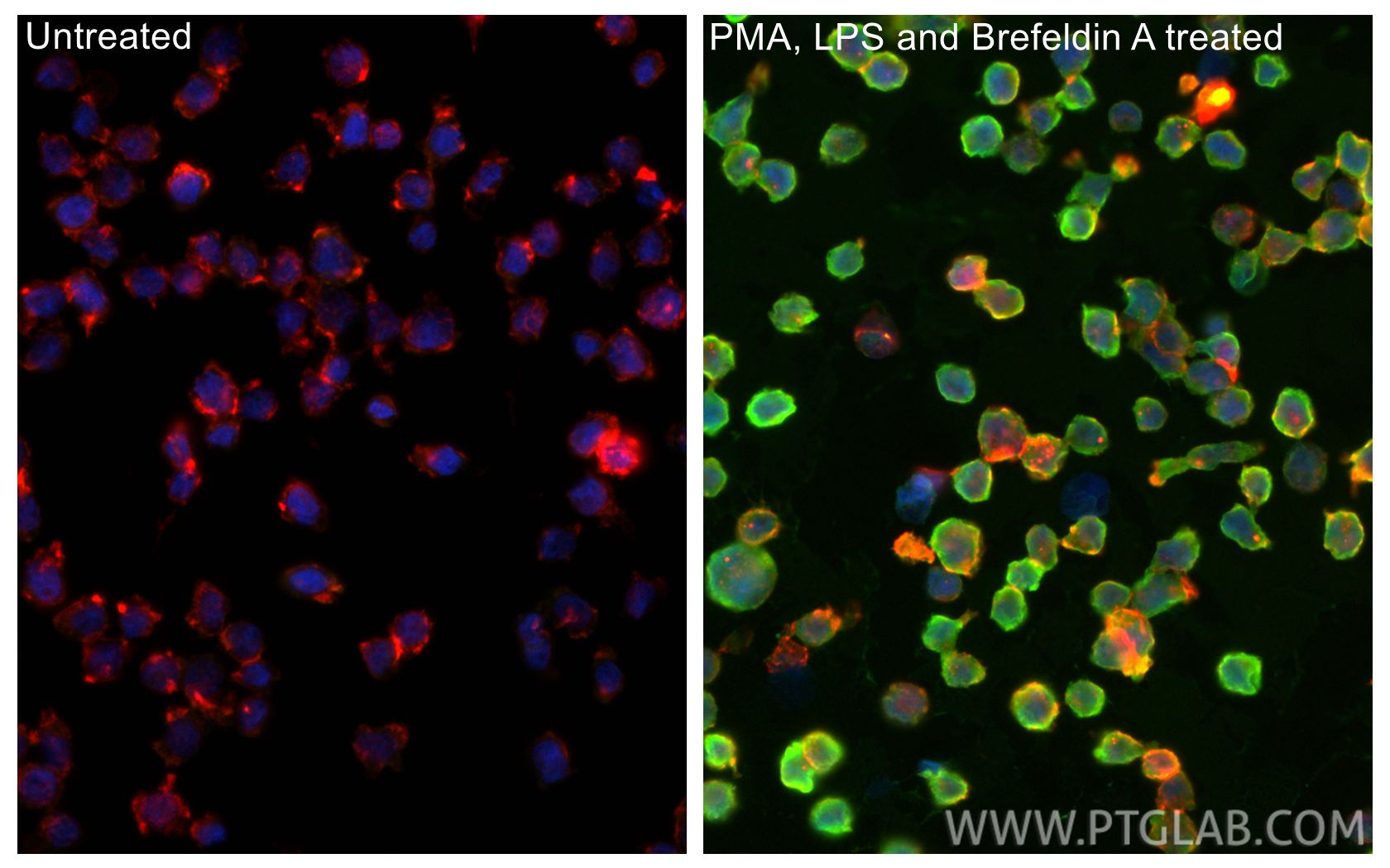 Immunofluorescent analysis of (4% PFA) fixed PMA, LPS and Brefeldin A treated THP-1 cells using IL-1 beta antibody (RMX00024) at dilution of 1:400 and CoraLite®488-Conjugated Goat Anti-Rabbit IgG(H+L) (SA00013-2), CL594-phalloidin (red). Immunofluorescence (IF) / fluorescent staining of THP-1 cells using Multi-rAb® IL-1 beta Multi-Recombinant antibody (RMX00024)