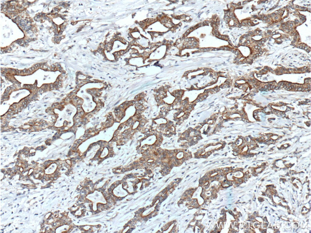 IL-10 Polyclonal antibody