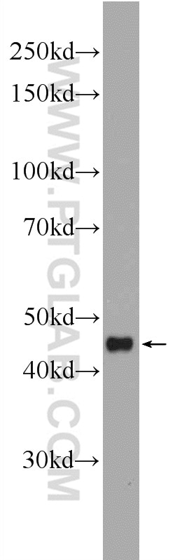 Western Blot (WB) analysis of Recombinant protein using IL-10 Polyclonal antibody (20850-1-AP)