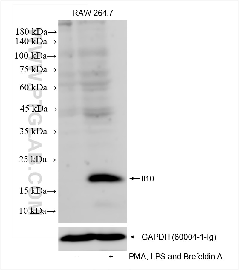 Western Blot (WB) analysis of various lysates using IL-10 Recombinant antibody (82191-3-RR)