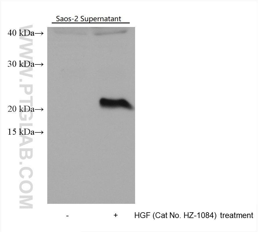 Western Blot (WB) analysis of various lysates using IL-11 Monoclonal antibody (68135-1-Ig)