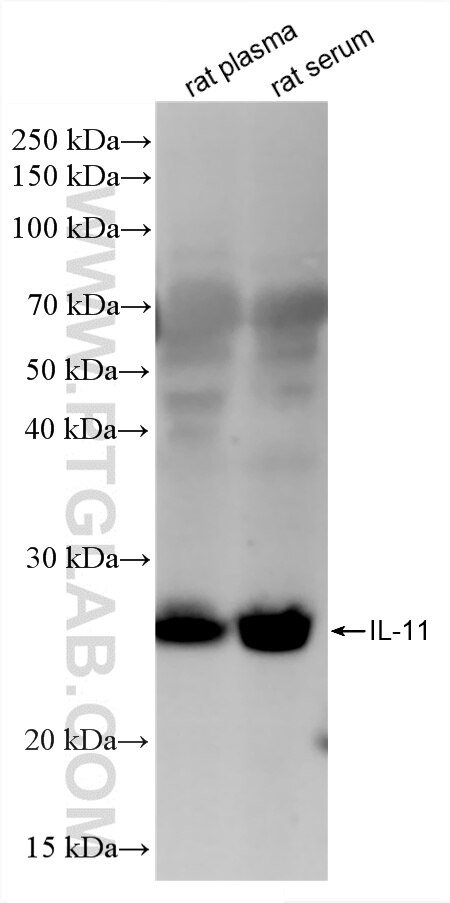 Western Blot (WB) analysis of various lysates using IL-11 Recombinant monoclonal antibody (87230-1-RR)