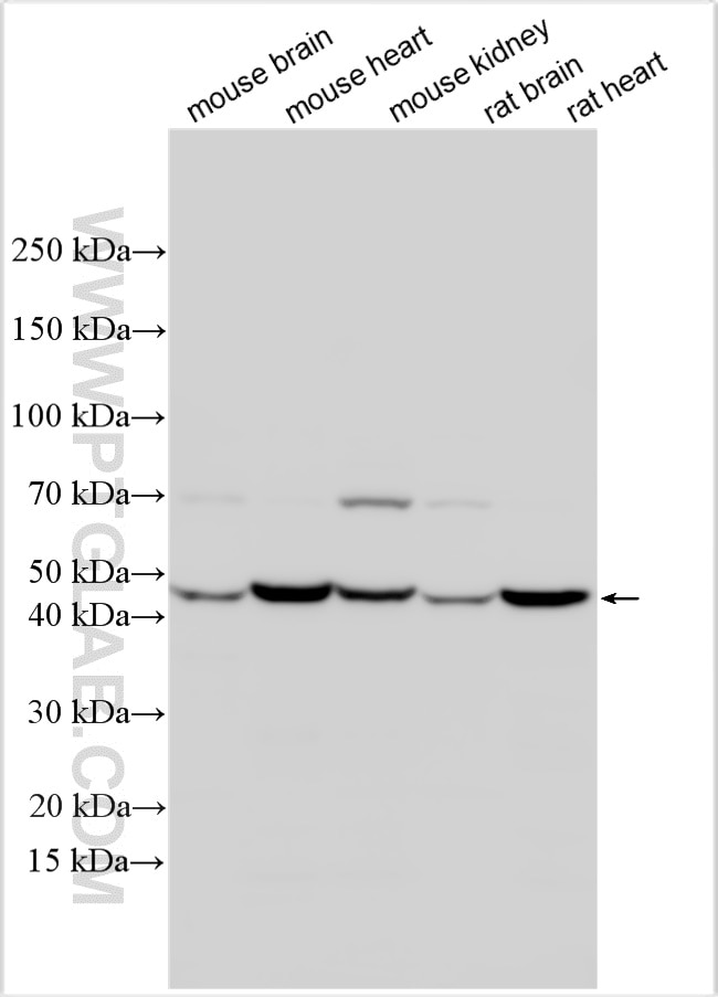 Western Blot (WB) analysis of various lysates using IL-12/IL-23 p40 Polyclonal antibody (30537-1-AP)