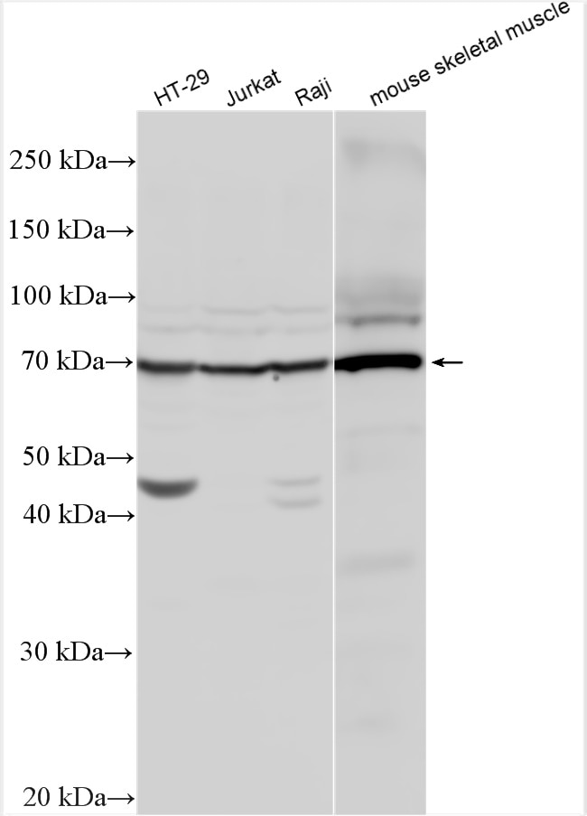 Western Blot (WB) analysis of various lysates using IL-13Rα1 Polyclonal antibody (27916-1-AP)