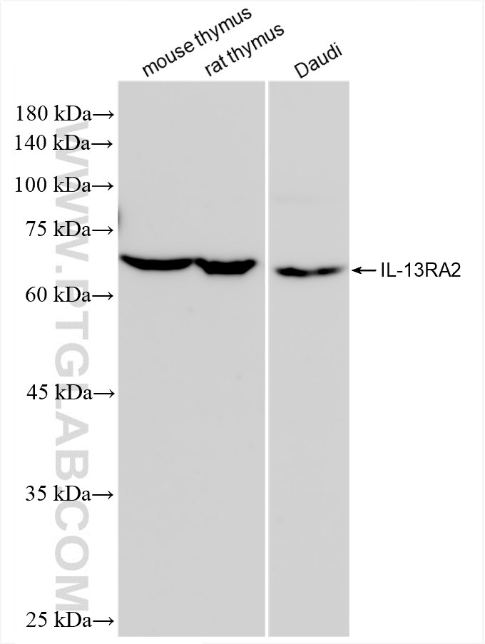 Western Blot (WB) analysis of various lysates using IL-13RA2 Recombinant antibody (85631-1-RR)