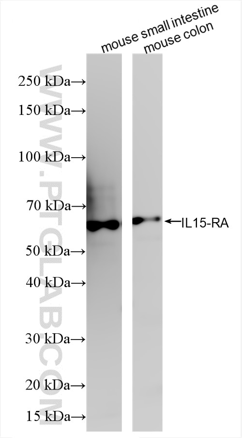 Western Blot (WB) analysis of various lysates using IL-15RA Recombinant antibody (85671-2-RR)