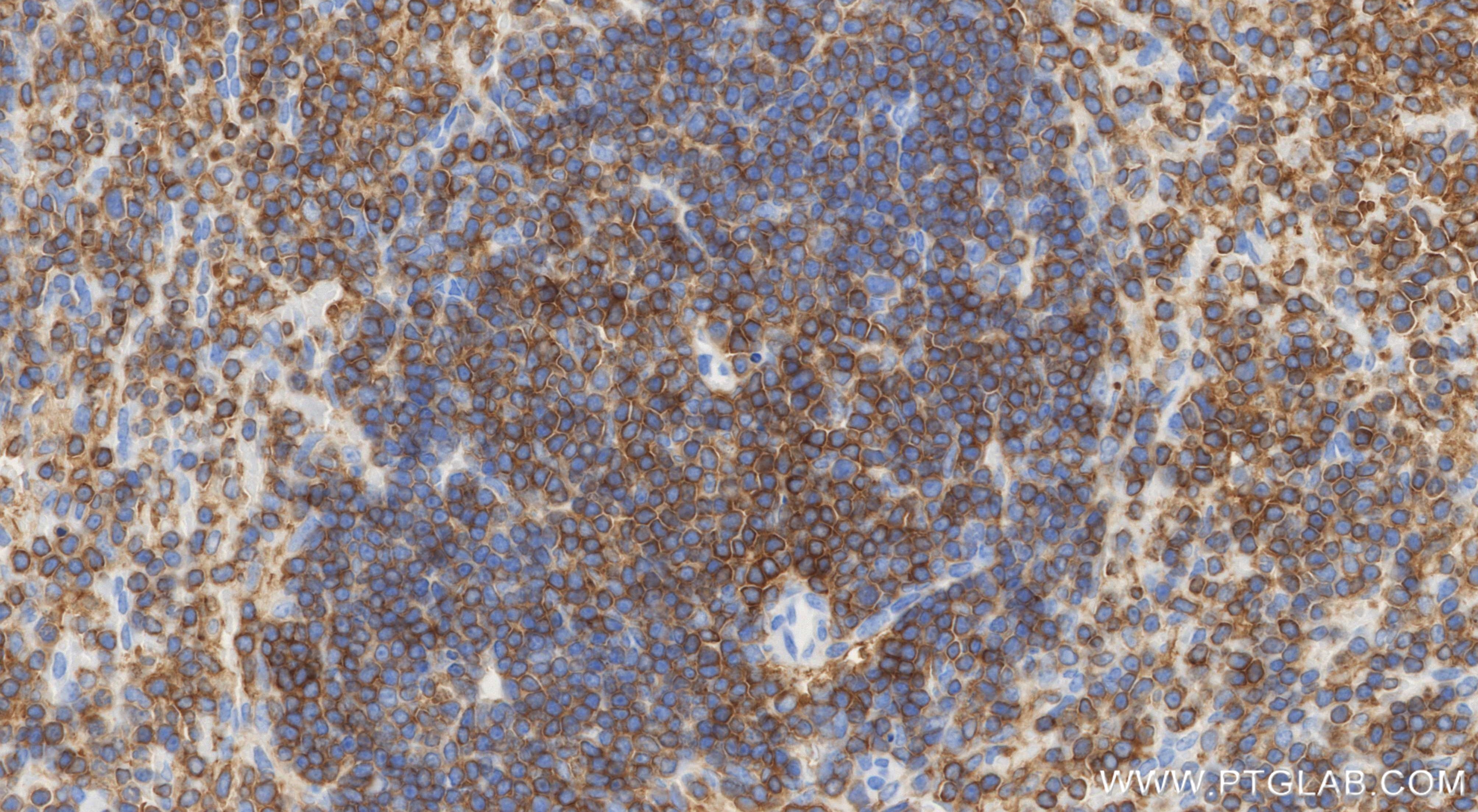 Immunohistochemistry (IHC) staining of mouse spleen tissue using IL-16 Recombinant monoclonal antibody (86421-1-RR)
